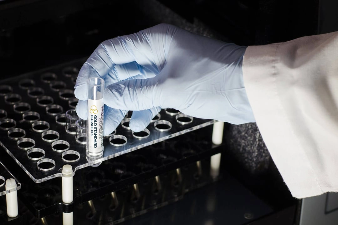 Single Assay Instruments Engineering - Gold Standard Diagnostics